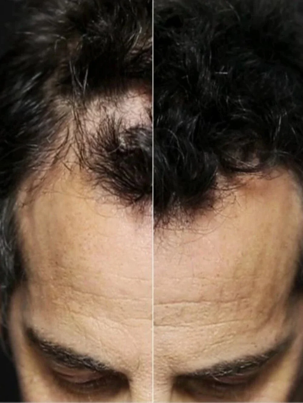 2 Toppik hair fiber (Dark Brown)...Limited Time Sale